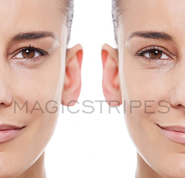 MAGICSTRIPES EYELID LIFTING - SMALL / 64 STRIPES - twentyfiveoseven Limited