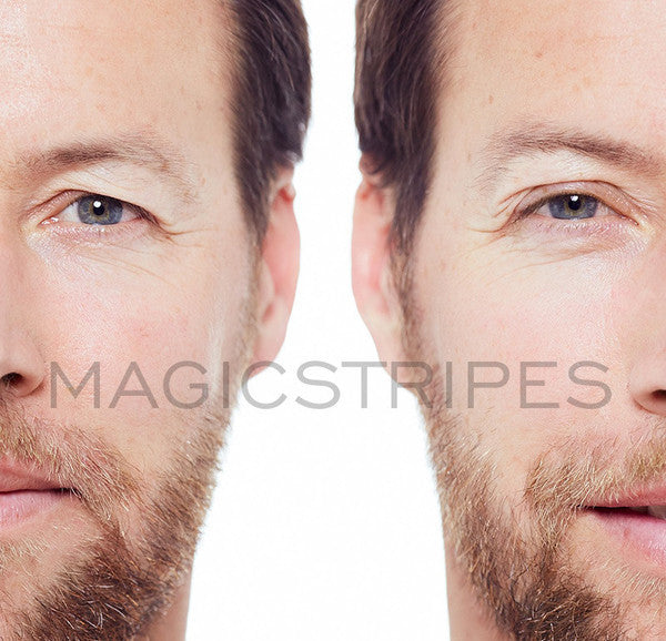 MAGICSTRIPES EYELID LIFTING - MEDIUM / 64 STRIPES - twentyfiveoseven Limited