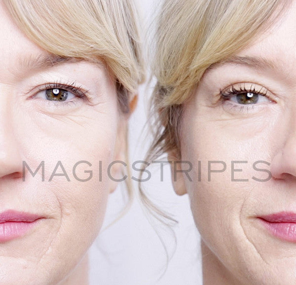 MAGICSTRIPES EYELID LIFTING - MEDIUM / 64 STRIPES - twentyfiveoseven Limited